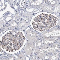SERPINB9 Polyclonal Antibody:Antibodies, Polyclonal