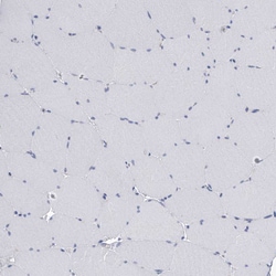 SERPINB9 Polyclonal Antibody:Antibodies, Polyclonal