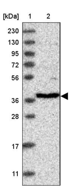 Invitrogen RFC3 Polyclonal Antibody 100 &mu;L; Unconjugated:Antibodies,