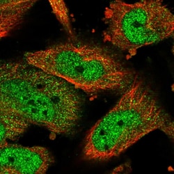 Invitrogen ATF5 Polyclonal Antibody 100 &mu;L; Unconjugated:Antibodies,