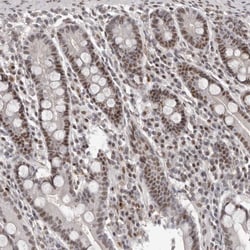 Invitrogen ATF5 Polyclonal Antibody 100 &mu;L; Unconjugated:Antibodies,