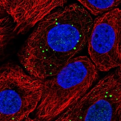 Invitrogen Filaggrin Polyclonal Antibody 100 &mu;L; Unconjugated:Antibodies,