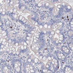 Invitrogen Filaggrin Polyclonal Antibody 100 &mu;L; Unconjugated:Antibodies,