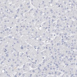 Invitrogen Filaggrin Polyclonal Antibody 100 &mu;L; Unconjugated:Antibodies,