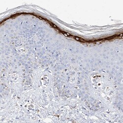 Invitrogen Filaggrin Polyclonal Antibody 100 &mu;L; Unconjugated:Antibodies,