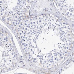 Invitrogen Filaggrin Polyclonal Antibody 100 &mu;L; Unconjugated:Antibodies,