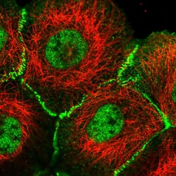Afadin Polyclonal Antibody:Antibodies, Polyclonal
