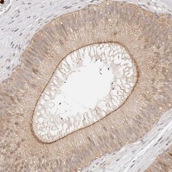 Afadin Polyclonal Antibody:Antibodies, Polyclonal