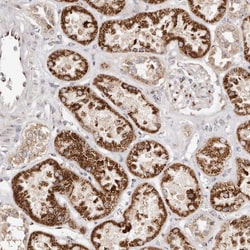 Invitrogen ERK3 Polyclonal Antibody 100 &mu;L; Unconjugated:Antibodies,