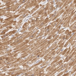 Invitrogen TFB2M Polyclonal Antibody 100 &mu;L; Unconjugated:Antibodies,