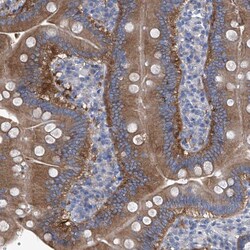 Invitrogen XPNPEP1 Polyclonal Antibody 100 &mu;L; Unconjugated:Antibodies,