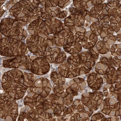 Galectin 8 Polyclonal Antibody:Antibodies, Polyclonal