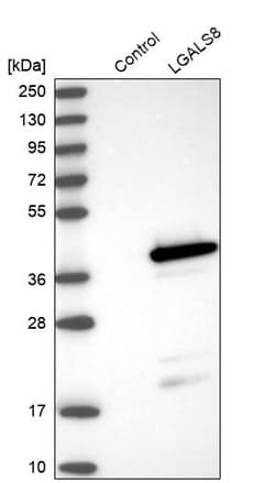 Invitrogen Galectin 8 Polyclonal Antibody 100 &mu;L | Buy Online | Invitrogen&trade; | Fisher Scientific