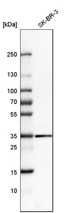 Invitrogen Galectin 8 Polyclonal Antibody 100 &mu;L | Buy Online | Invitrogen&trade; | Fisher Scientific