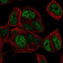 Invitrogen TLX3 Polyclonal Antibody 100 &mu;L; Unconjugated:Antibodies,