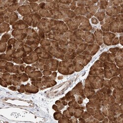 Invitrogen eIF4H Polyclonal Antibody 100 &mu;L; Unconjugated:Antibodies,
