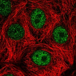 DEDD Polyclonal Antibody:Antibodies, Polyclonal