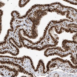 Invitrogen CKS2 Polyclonal Antibody 100 &mu;L | Buy Online | Invitrogen&trade; | Fisher Scientific