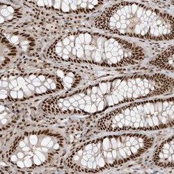 Invitrogen CKS2 Polyclonal Antibody 100 &mu;L | Buy Online | Invitrogen&trade; | Fisher Scientific