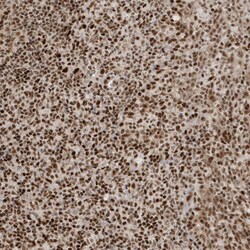 Invitrogen CKS2 Polyclonal Antibody 100 &mu;L | Buy Online | Invitrogen&trade; | Fisher Scientific