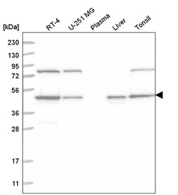 Invitrogen NCK1 Polyclonal Antibody 100 &mu;L; Unconjugated:Antibodies,