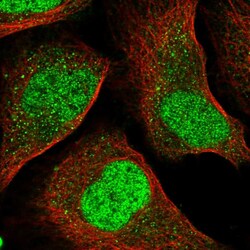 Invitrogen IRF2 Polyclonal Antibody 100 &mu;L; Unconjugated:Antibodies,