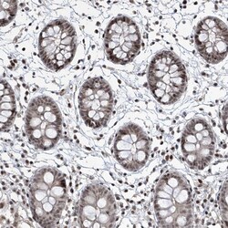 Invitrogen IRF2 Polyclonal Antibody 100 &mu;L; Unconjugated:Antibodies,