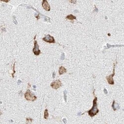 Invitrogen LRRC59 Polyclonal Antibody 100 &mu;L; Unconjugated:Antibodies,