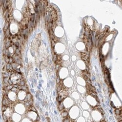 Invitrogen LRRC59 Polyclonal Antibody 100 &mu;L; Unconjugated:Antibodies,