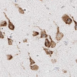 Invitrogen LRRC59 Polyclonal Antibody 100 &mu;L; Unconjugated:Antibodies,