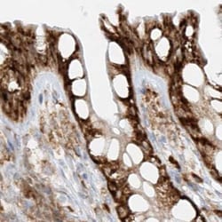 Invitrogen LRRC59 Polyclonal Antibody 100 &mu;L; Unconjugated:Antibodies,