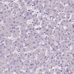 Invitrogen ADAM12 Polyclonal Antibody 100 &mu;L; Unconjugated:Antibodies,