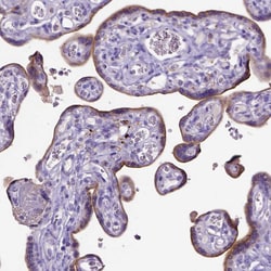 Invitrogen ADAM12 Polyclonal Antibody 100 &mu;L; Unconjugated:Antibodies,