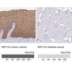 Cytokeratin 13 Polyclonal Antibody, Invitrogen 100 &mu;L; Unconjugated:Antibodies,