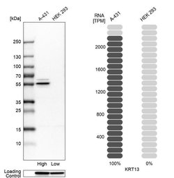 Cytokeratin 13 Polyclonal Antibody, Invitrogen 100 &mu;L; Unconjugated:Antibodies,