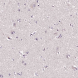 Invitrogen Golgi protein 58k Polyclonal Antibody 100 &mu;L; Unconjugated:Antibodies,