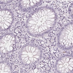 Invitrogen Golgi protein 58k Polyclonal Antibody 100 &mu;L; Unconjugated:Antibodies,