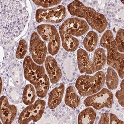 Invitrogen Golgi protein 58k Polyclonal Antibody 100 &mu;L; Unconjugated:Antibodies,