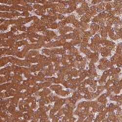 Invitrogen Golgi protein 58k Polyclonal Antibody 100 &mu;L; Unconjugated:Antibodies,