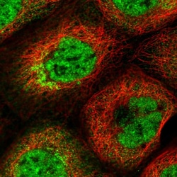 Invitrogen HDAC5 Polyclonal Antibody 100 &mu;L; Unconjugated:Antibodies,
