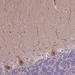 Invitrogen HDAC5 Polyclonal Antibody 100 &mu;L; Unconjugated:Antibodies,