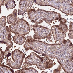 Invitrogen HDAC5 Polyclonal Antibody 100 &mu;L; Unconjugated:Antibodies,