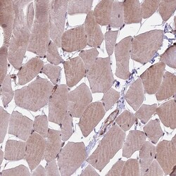 Invitrogen HDAC5 Polyclonal Antibody 100 &mu;L; Unconjugated:Antibodies,