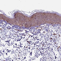 Invitrogen HDAC5 Polyclonal Antibody 100 &mu;L; Unconjugated:Antibodies,