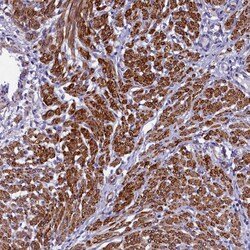 Invitrogen Bcl-rambo Polyclonal Antibody 100 &mu;L; Unconjugated:Antibodies,
