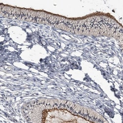 Invitrogen CD133 Polyclonal Antibody 100 &mu;L; Unconjugated:Antibodies,