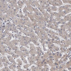 Invitrogen CD133 Polyclonal Antibody 100 &mu;L; Unconjugated:Antibodies,