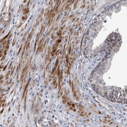 Invitrogen CD133 Polyclonal Antibody 100 &mu;L; Unconjugated:Antibodies,