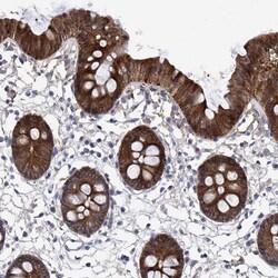 Invitrogen GPT Polyclonal Antibody 100 &mu;L; Unconjugated:Antibodies,