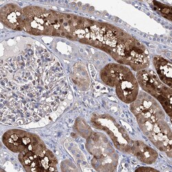 Invitrogen GPT Polyclonal Antibody 100 &mu;L; Unconjugated:Antibodies,